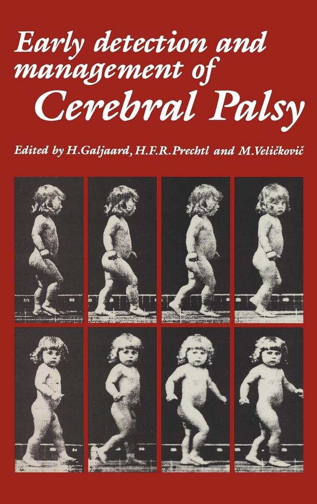 Early Detection and Management of Cerebral Palsy