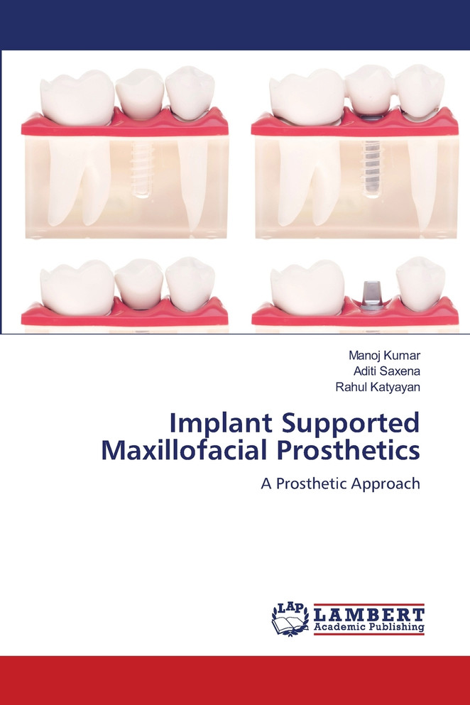 Implant Supported Maxillofacial Prosthetics
