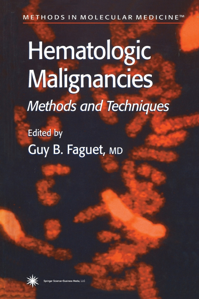 Hematologic Malignancies