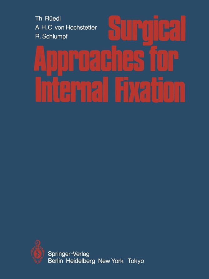 Surgical Approaches for Internal Fixation