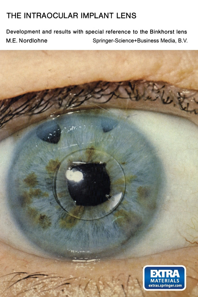 The Intraocular Implant Lens Development and Results with Special Reference to the Binkhorst Lens