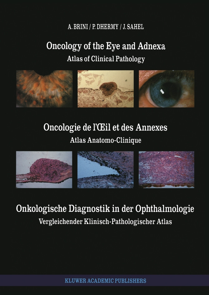 Oncology of the Eye and Adnexa / Oncologie de l'Œil et des Annexes / Onkologische Diagnostik in der Ophthalmologie