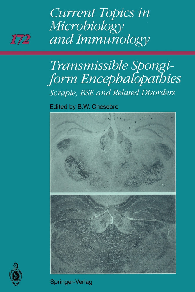 Transmissible Spongiform Encephalopathies