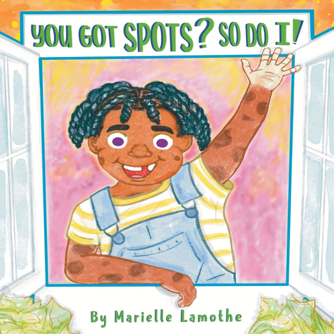 You Got Spots? So Do I !