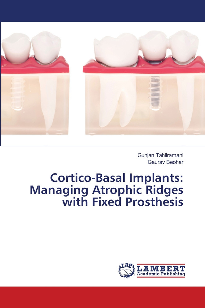 Cortico-Basal Implants