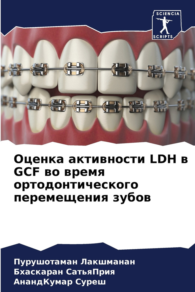 Оценка активности LDH в GCF во время ортодонтического перемещения зубов