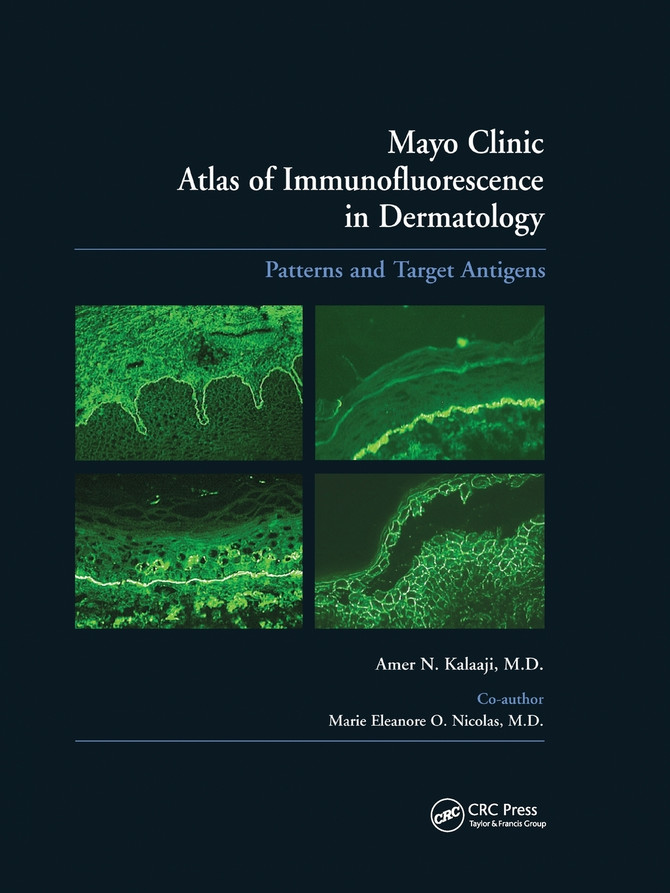 Mayo Clinic Atlas of Immunofluorescence in Dermatology