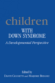 Children with Down Syndrome