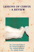 LESIONS OF CERVIX - A REVIEW