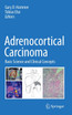 Adrenocortical Carcinoma
