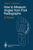 How to Measure Angles from Foot Radiographs
