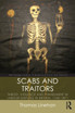 Scabs and Traitors