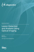 Lesion Detection and Analysis Using Optical Imaging