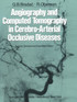 Angiography and Computed Tomography in Cerebro-Arterial Occlusive Diseases