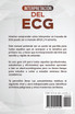 Interpretación del ECG