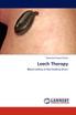Leech Therapy