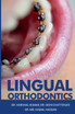 Lingual Orthodontics by Kumar Harshal (Paperback)