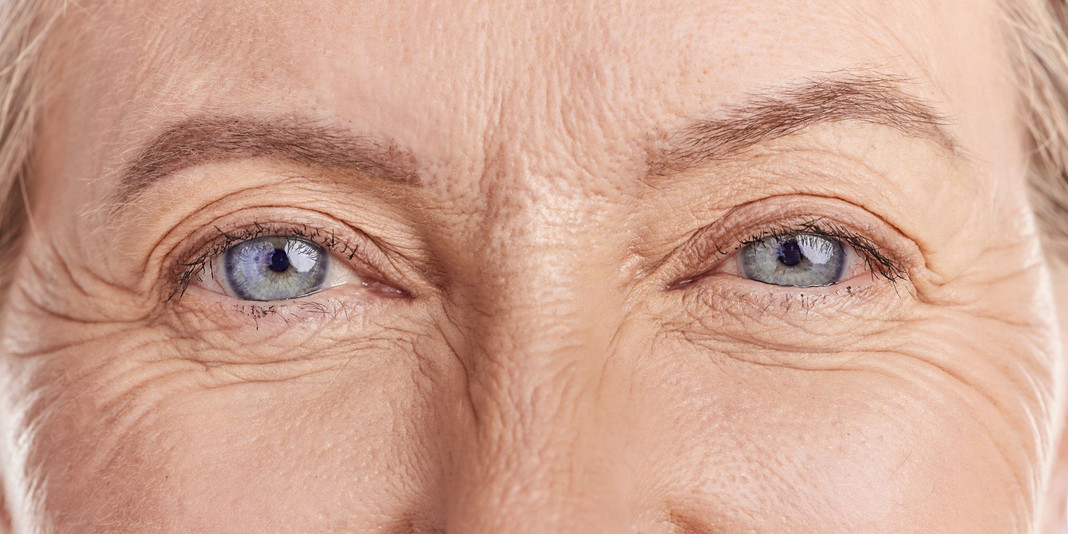 Dry Skin Around the Eyes – Why It Happens and How to Support It