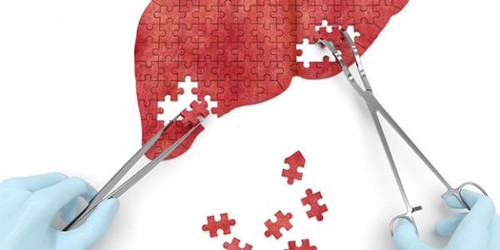Milk Thistle For Liver Detoxification