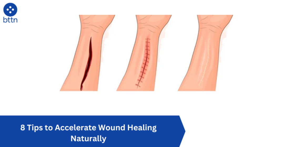 8 Tips to Accelerate Wound Healing Naturally