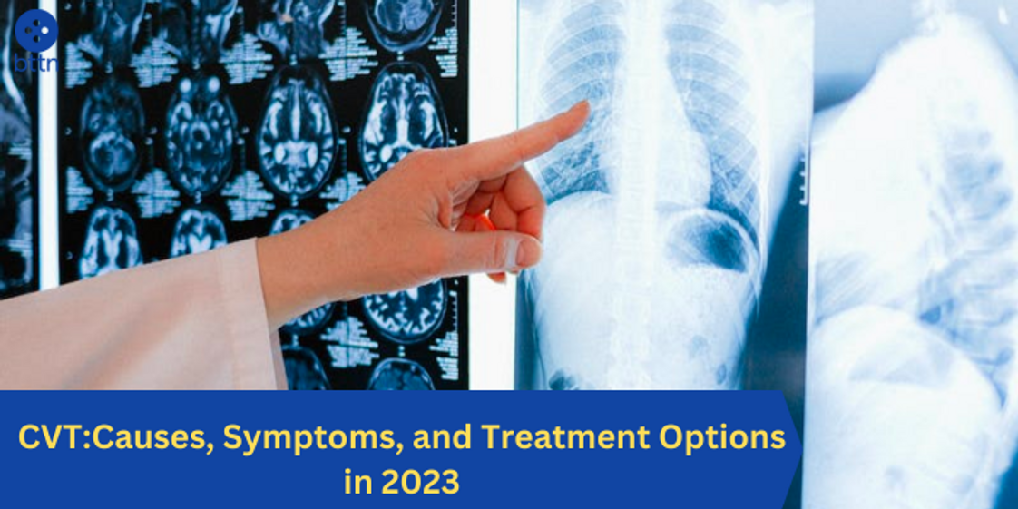 CVT: Causes, Symptoms, and Treatment Options in 2023