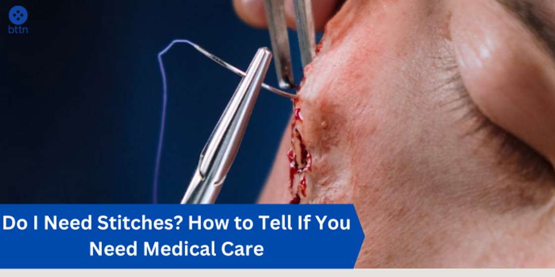 Do I Need Stitches? How to Tell If You Need Medical Care