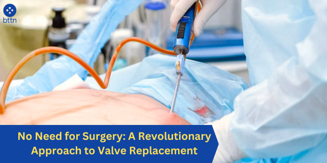 No Need for Surgery: A Revolutionary Approach to Valve Replacement