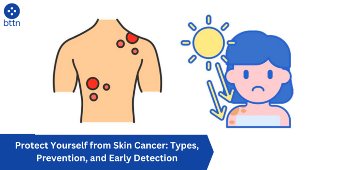 Protect Yourself from Skin Cancer: Types, Prevention, and Early Detection