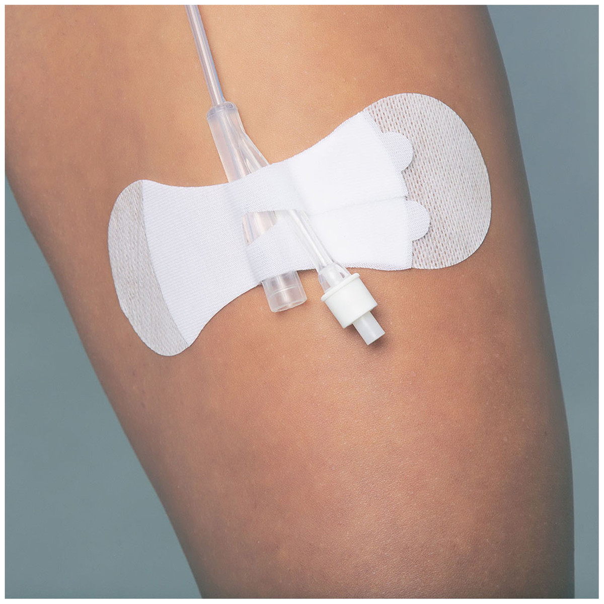 Tidi Grip-Lok Foley Securement Device Tidi Grip-Lok Foley Securement Device