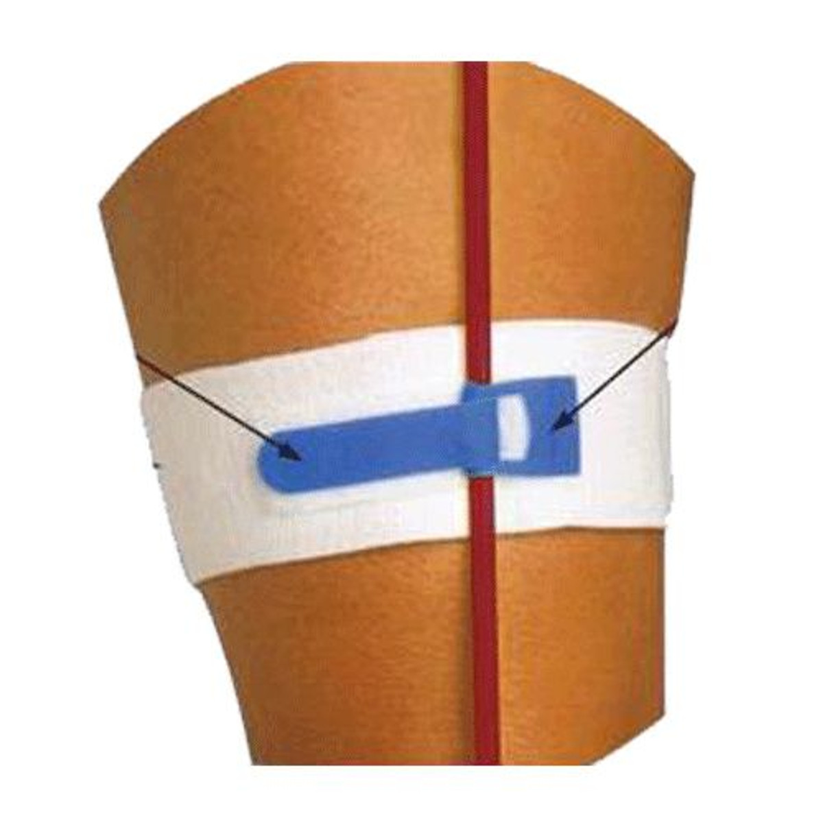Pepper Medical Foley Catheter Legbands Pepper Medical Foley Catheter Legbands