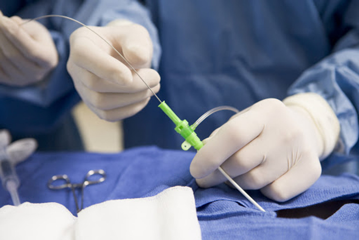 Busse Angiogram Tray