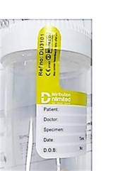 D.U. Medical Click Top Lid Specimen Cups 90ml