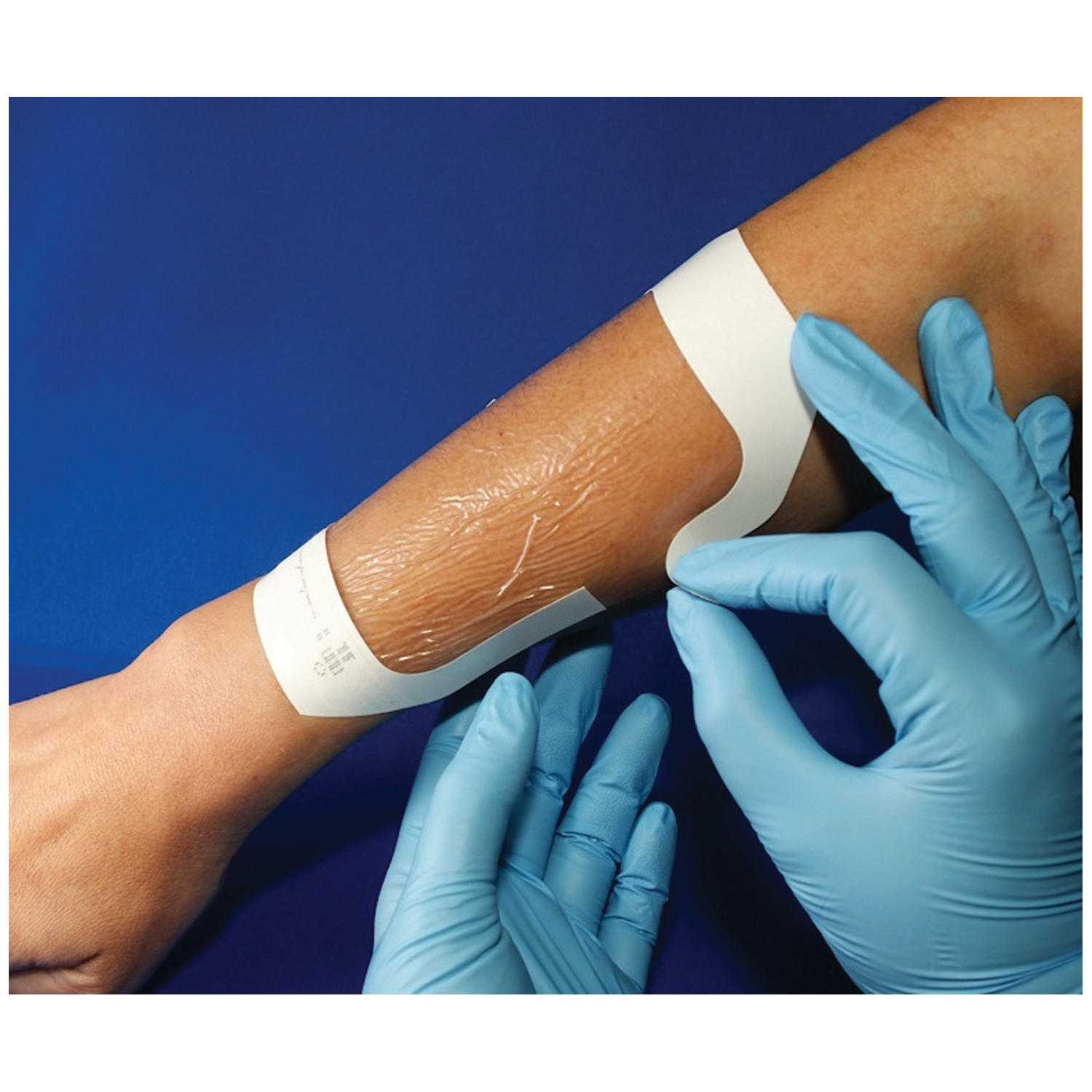 Amd Medicom Transparent Dressing