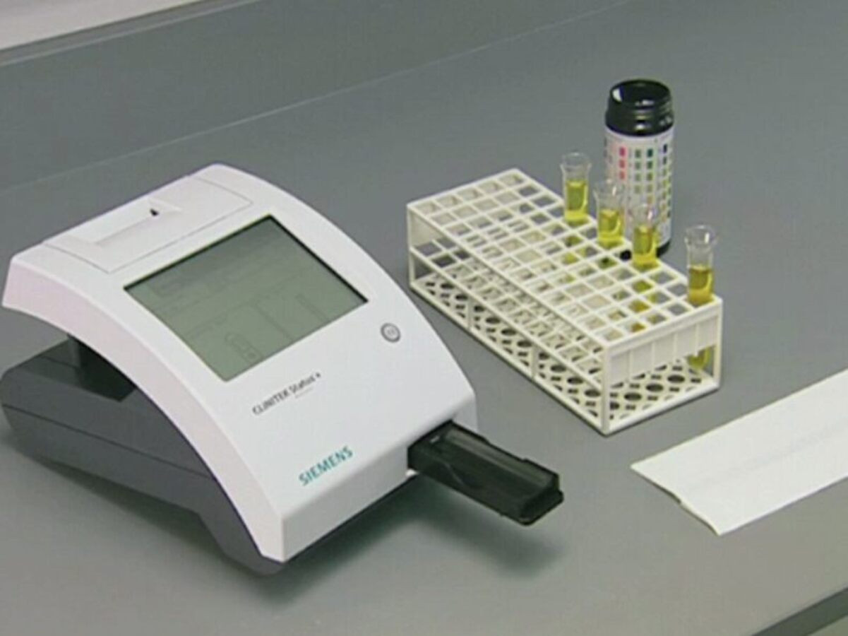 Siemens Clinitek Status Upgrade Kit