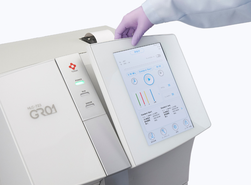 Tosoh Diabetes Assay