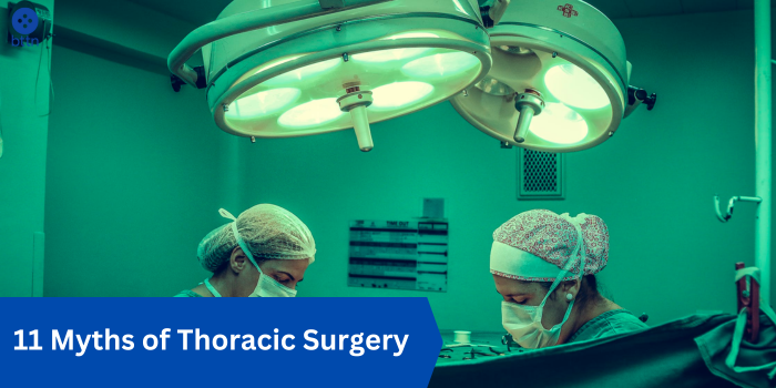 11 Myths of Thoracic Surgery