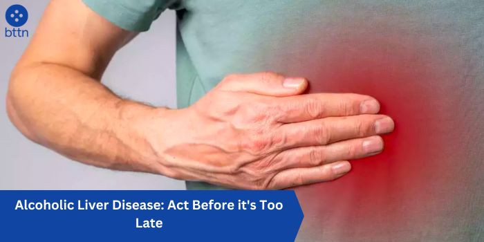 Alcoholic Liver Disease: Act Before it's Too Late
