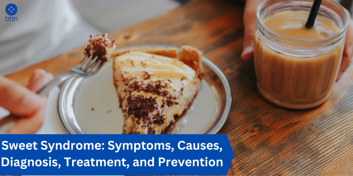 Sweet Syndrome: Symptoms, Causes, Diagnosis, Treatment, and Prevention