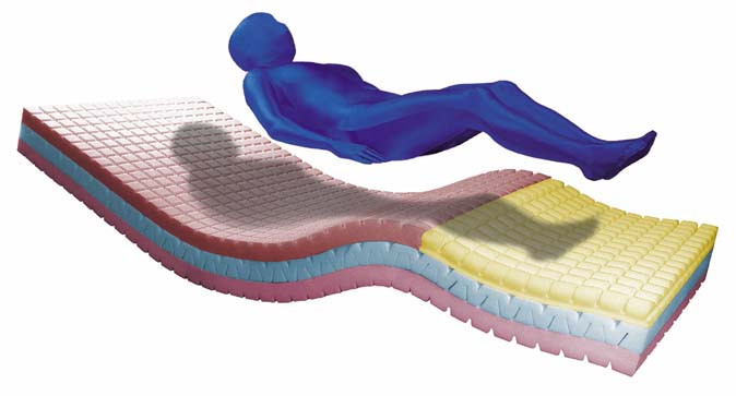 Blue Chip Pre-Vent Series Pressure Relieving Mattress System Accessories