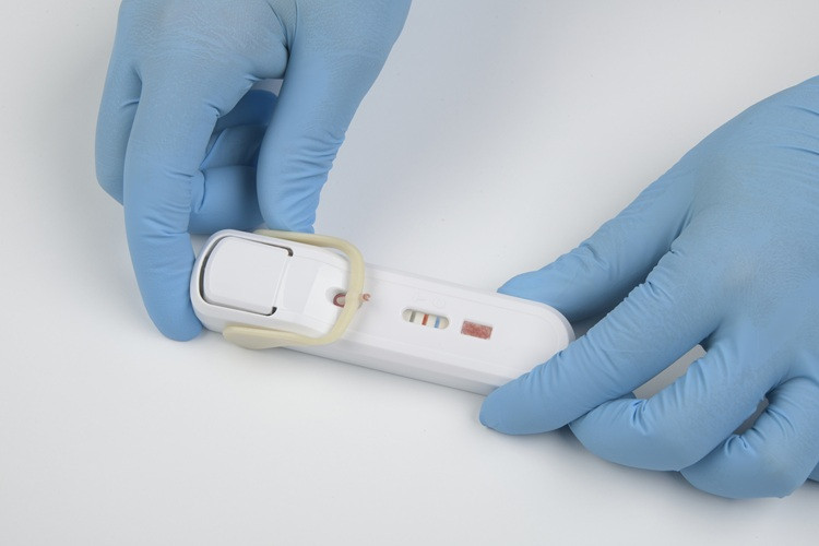 Phase Scientific Febridx Rapid Test Kits