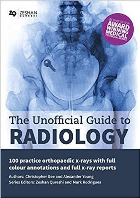 http://axebook.shop/wp-content/uploads/2025/03/1582192804-1890537761-the-unofficial-guide-to-radiology-100-practice-orthopaedic-x-rays-with-full-colour-annotations-and-full-x-ray-reports-unofficial-guides-to-medicine.jpg http://axebook.shop/wp-content/uploads/2025/03/1582192804-1890537761-the-unofficial-guide-to-radiology-100-practice-orthopaedic-x-rays-with-full-colour-annotations-and-full-x-ray-reports-unofficial-guides-to-medicine.jpg