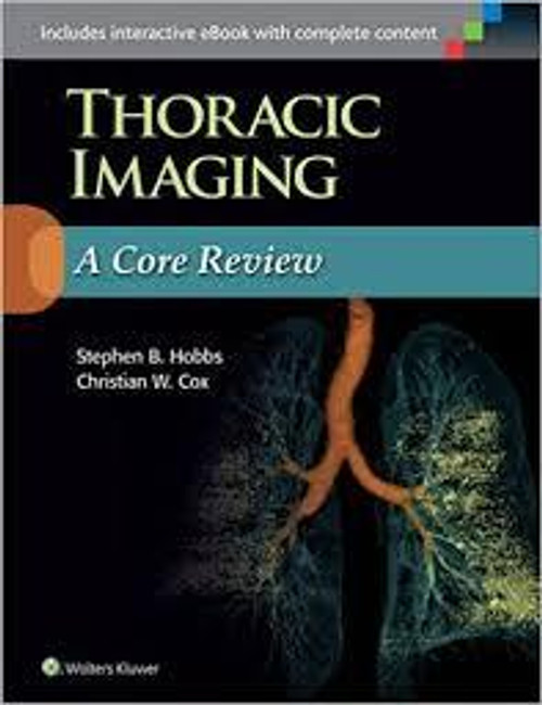 http://axebook.shop/wp-content/uploads/2025/03/thoracic-imaging-a-core-review-first-revised-reprint-edition-thoracic-imaging-a-core-review-first-revised-reprint-edition.jpg