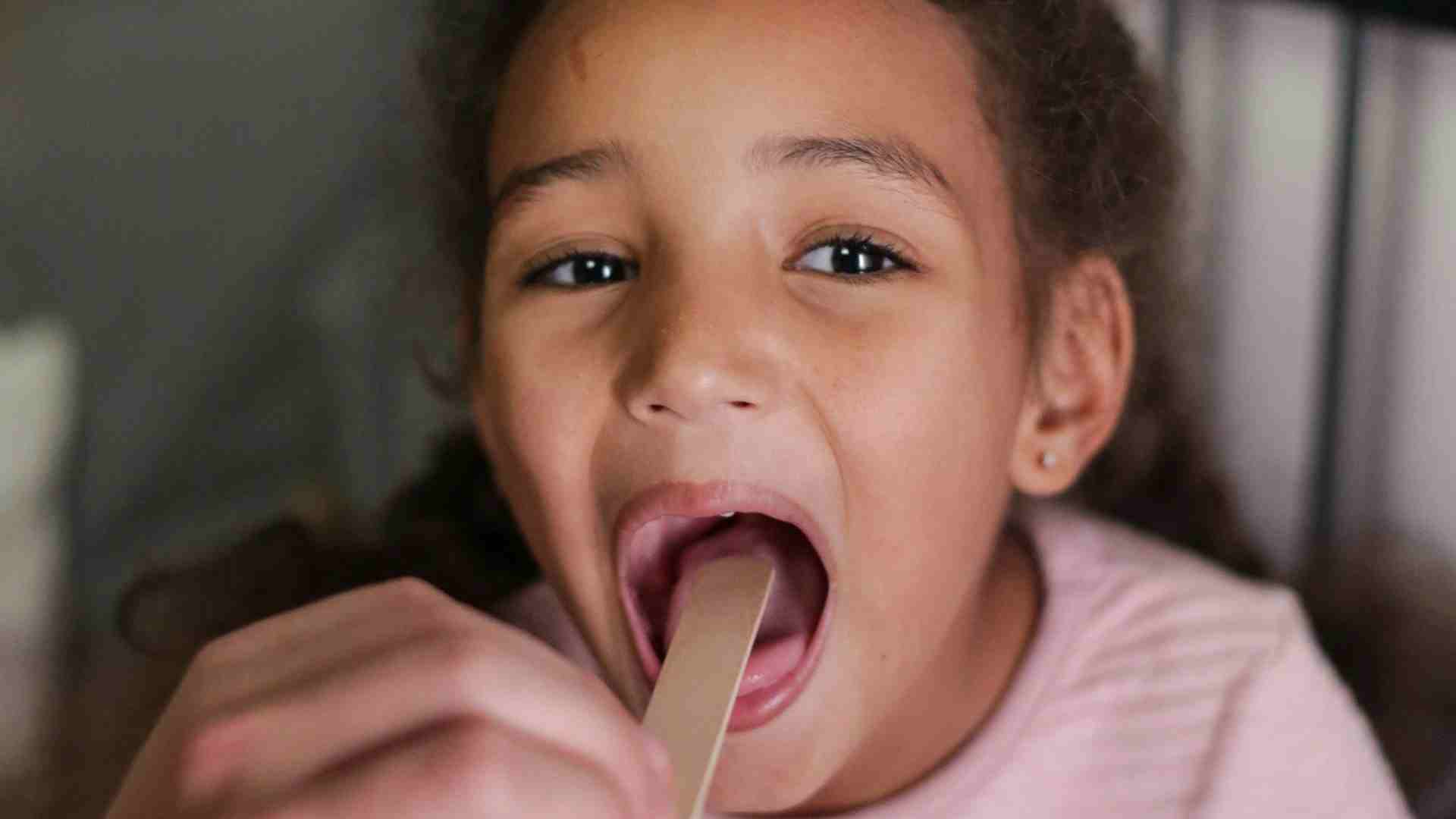 A girl with a sore throat seen with a wooden stick pressed on their tongue.