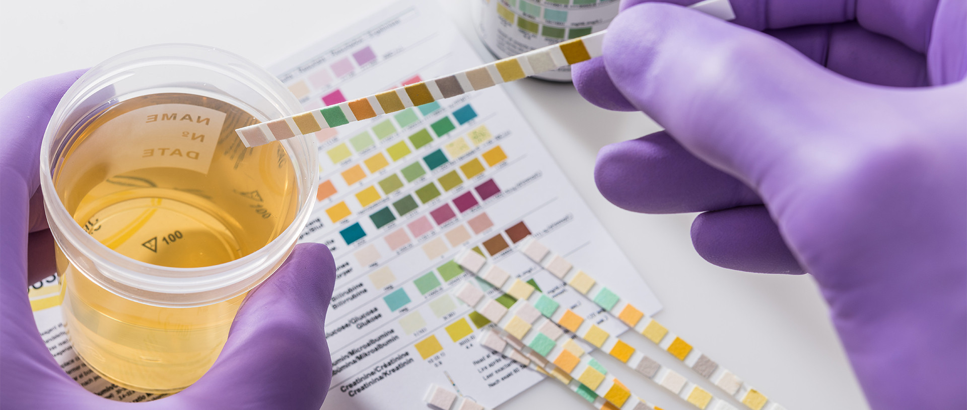 Does Kratom Show Up on a Drug Test?  thumbnail image
