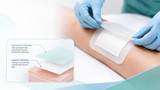 Primary vs Secondary Wound Dressings, Explained Simply