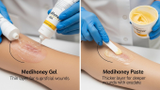 Medihoney Gel vs Paste: Understanding the Difference