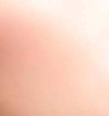 Normal Skin Normal Skin