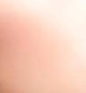 Normal Skin