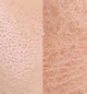 Combination skin
