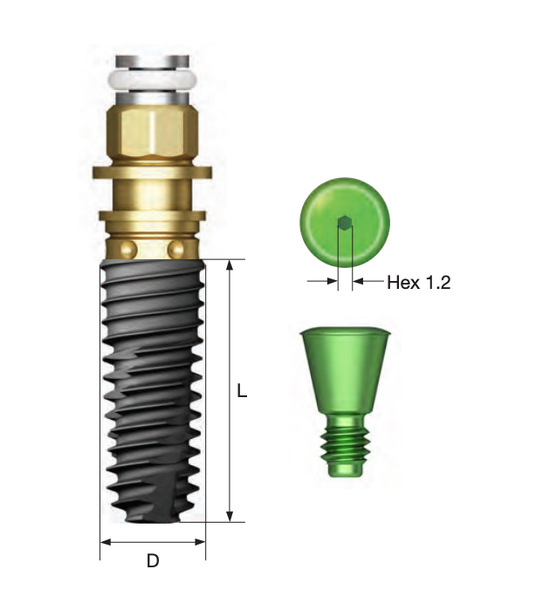 BTSIII CA Implant